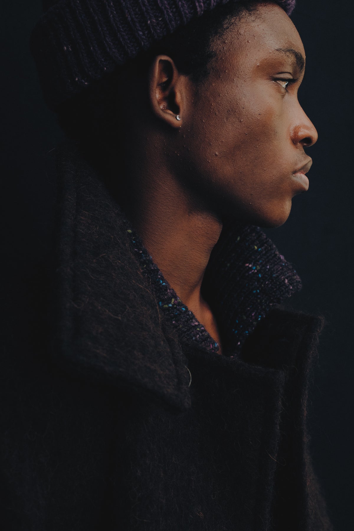 ANSO COAT